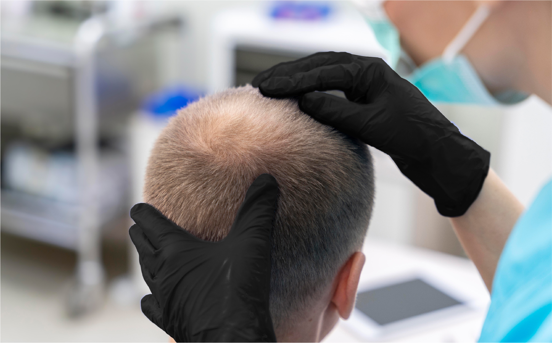 The ABCs of Hair Implants in Bogotá: Glossary of Terms to Understand Everything