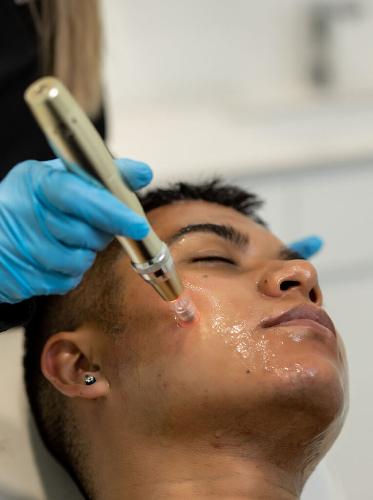 Dermapen-Precio-bogota-1-764x1024