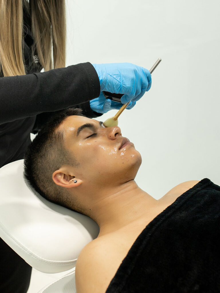 Dermapen-en-bogota-768x1024